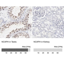 NCAPH Antibody, Novus Biologicals:Antibodies:Primary Antibodies